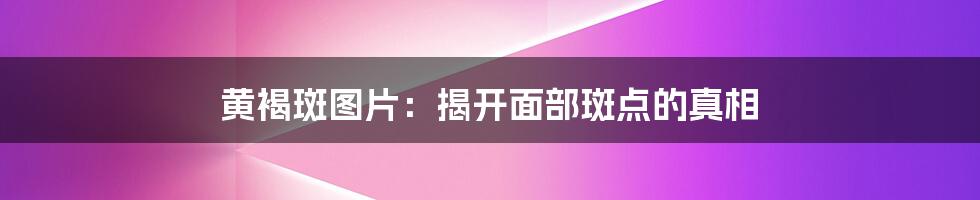 黄褐斑图片：揭开面部斑点的真相