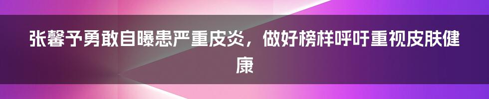 张馨予勇敢自曝患严重皮炎，做好榜样呼吁重视皮肤健康