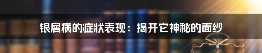 银屑病的症状表现：揭开它神秘的面纱