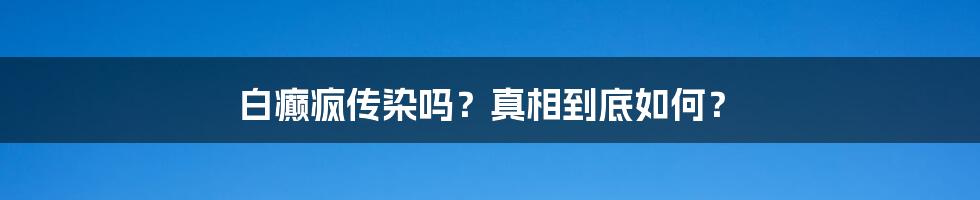 白癫疯传染吗？真相到底如何？