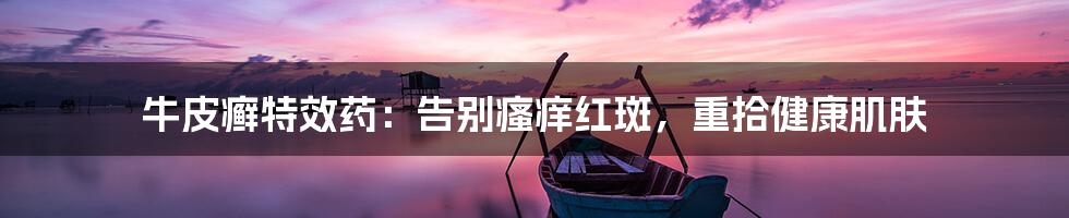 牛皮癣特效药：告别瘙痒红斑，重拾健康肌肤