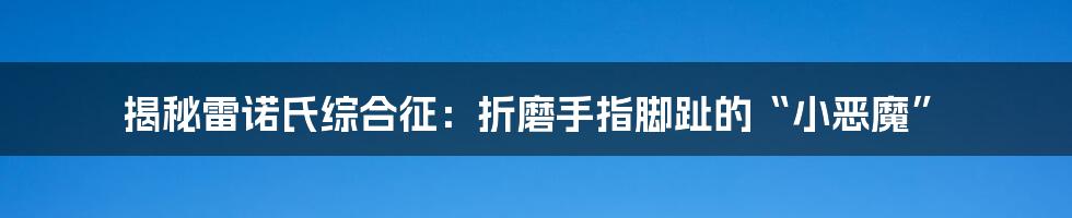 揭秘雷诺氏综合征：折磨手指脚趾的“小恶魔”