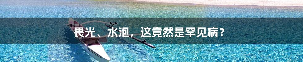 畏光、水泡，这竟然是罕见病？