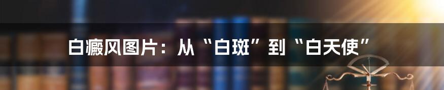 白癜风图片：从“白斑”到“白天使”